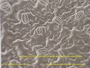estômatos, visto em elétron-micrografia de varredura